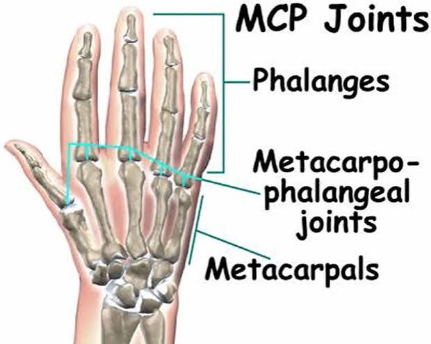 MCP IP